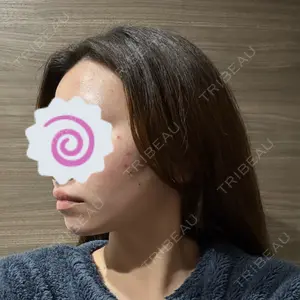 L‘amour clinic Tokyo【ラムールクリニック東京】口コミ