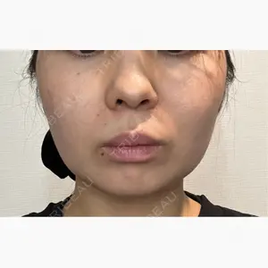 共立美容外科 梅田院口コミ