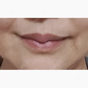 ルラ美容クリニック 上野院口コミ