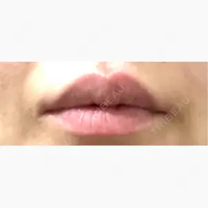 ルヴィクリニック イオンドーム前院口コミ