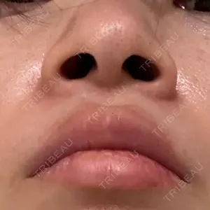 Re:anne clinic 銀座 【リアンクリニック銀座】口コミ