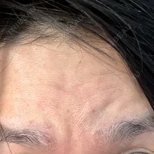 TCB東京中央美容外科 豊田院口コミ