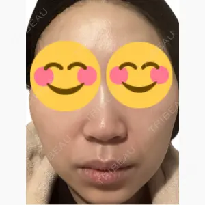 美容皮膚科エルムクリニック 麻布院口コミ