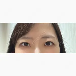LUHO（ルホ）美容外科口コミ