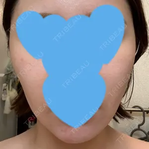 FACE SKIN CLINIC 池袋口コミ