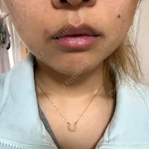 小暮整形外科・美容外科口コミ