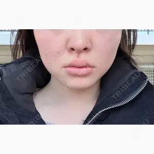 RIVER CLINIC（リバークリニック）口コミ