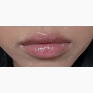HAAB BEAUTY CLINIC 南青山本院（新院）口コミ
