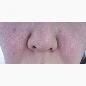 BELINDA CLINIC（ベリンダクリニック）柏院口コミ