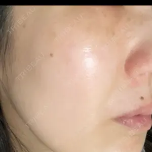 ルラ美容クリニック 静岡院口コミ