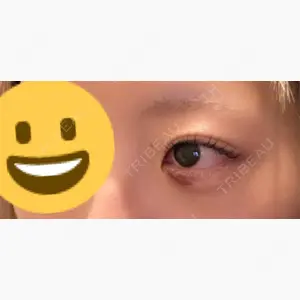 東京形成美容外科 船橋院口コミ