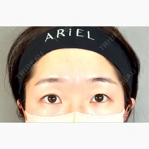 アリエル美容クリニック 大宮院口コミ