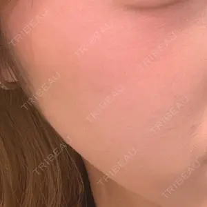 共立美容外科 銀座院口コミ