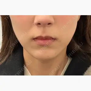 ライブリークリニック 大阪院口コミ