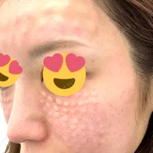 NARU Beauty Clinic 【ナルクリ】 水戸院口コミ