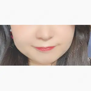 ルラ美容クリニック 仙台院 / ルラスキンクリニック 仙台院口コミ