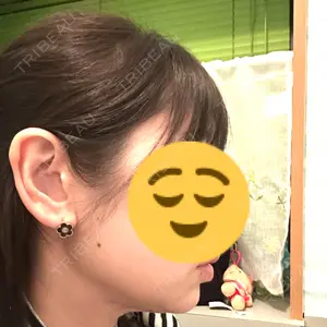 4Dクリニック口コミ