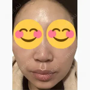 美容皮膚科エルムクリニック 麻布院口コミ