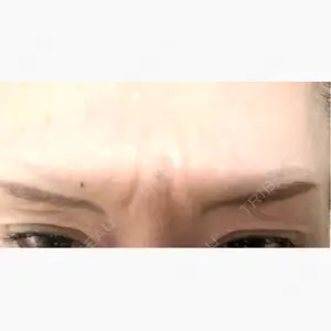 NARU Beauty Clinic 【ナルクリ】 水戸院口コミ