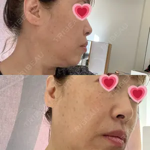 サラ美容外科口コミ