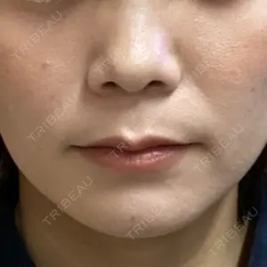 ルラ美容クリニック 宇都宮院口コミ