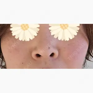 広島本通り美容クリニック口コミ