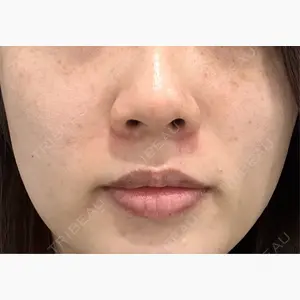 東京美容外科 福岡院口コミ