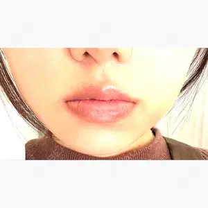 メディカルアルファクリニック口コミ