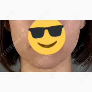 アリエル美容クリニック 郡山院口コミ