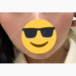 共立美容外科 梅田院口コミ