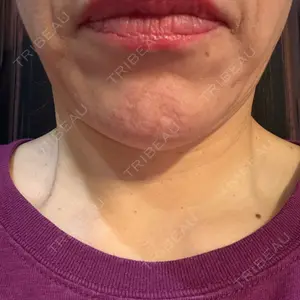 アネシス美容クリニック口コミ