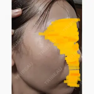 ピュアクリニック 西大寺院口コミ