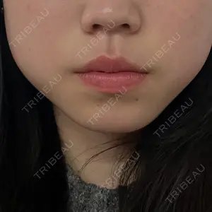 ルラ美容クリニック 京都院口コミ