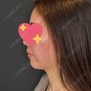 PRO CLINIC プロクリニック 銀座院口コミ