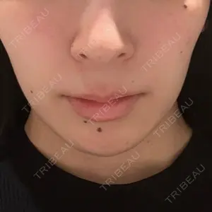 HAAB×DREAM BEAUTY CLINIC 東京本院口コミ