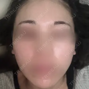 レナータクリニック 立川院口コミ