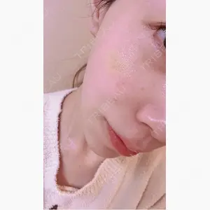 博多美容外科/美容皮膚科 ビラビューティークリニック口コミ