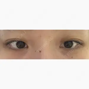 アリエル美容クリニック 郡山院口コミ