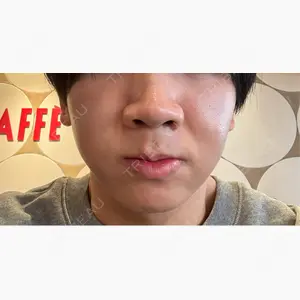 東京美容外科 新宿院口コミ