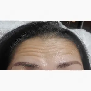 広島本通り美容クリニック口コミ