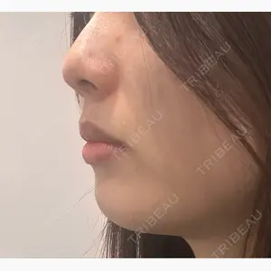 博多美容外科/美容皮膚科 ビラビューティークリニック口コミ