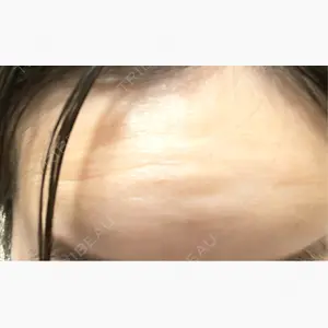 おおたかの森ビューティークリニック口コミ