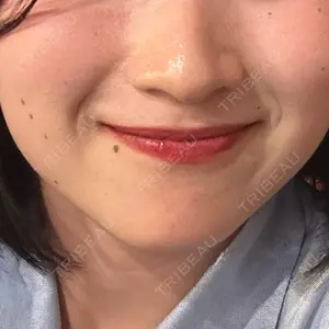 TCB東京中央美容外科 越谷院口コミ