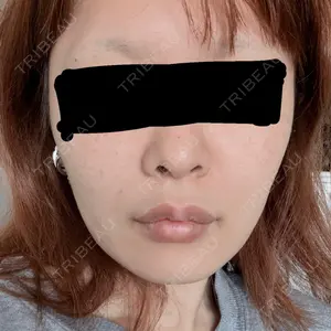 X CLINIC 恵比寿院口コミ
