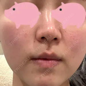 レナータクリニック 立川院口コミ