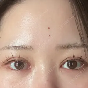 プライベートスキンクリニック 梅田本院口コミ