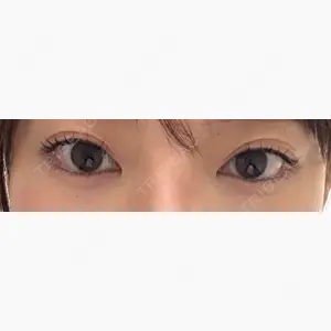 ルラ美容クリニック 新宿院口コミ