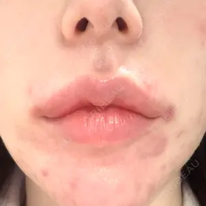 フィラークリニック 名古屋栄院口コミ