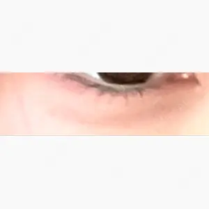 ルラ美容クリニック 札幌本院口コミ