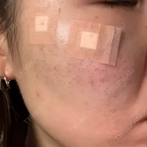 CLEAN BEAUTY CLINIC TokyoAzabu口コミ